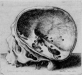 Распиленный человеческий череп